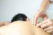 Link to: /services/acupuncture